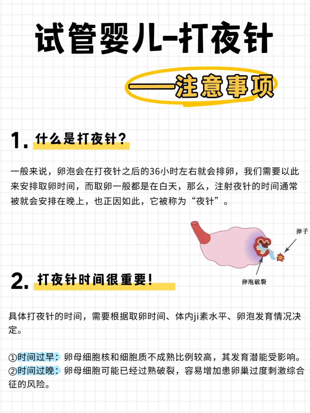夜针注射：试管婴儿的关键步骤及周全考量