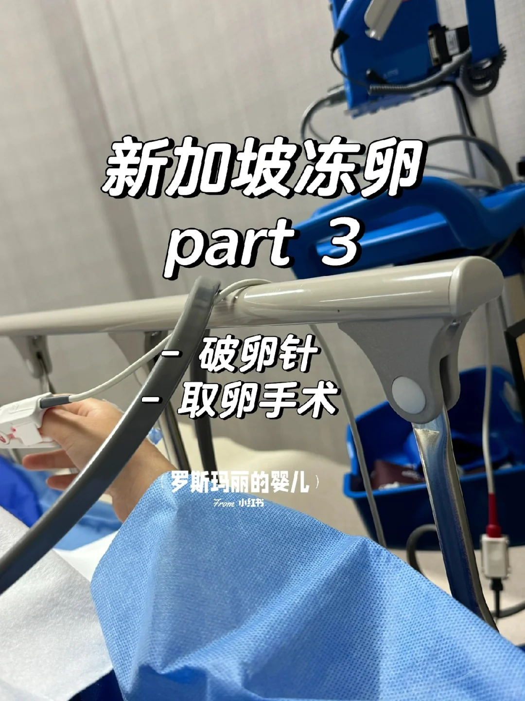 新加坡冻卵经历：破卵针与取卵过程分享