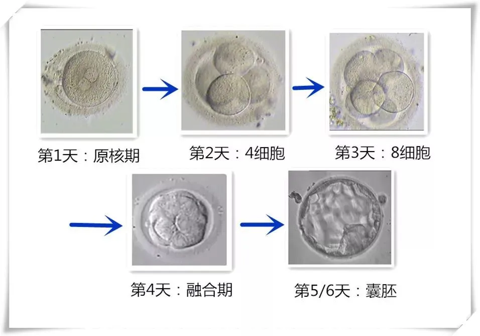 囊胚培养天数解析与助孕费用考量